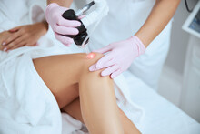 Doctor Conducting The Treatment Procedure Of The Spider Veins