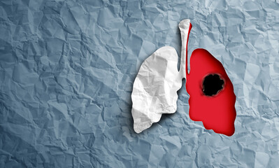 Wall Mural - lung cancer diagnosis
