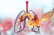 Human lung cancer with dna strand. 3d illustration.