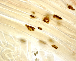 Sticker - Motor end plates. Acetylcholinesterase