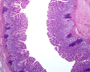 Sticker - Gastric mucosa. Pyloric region