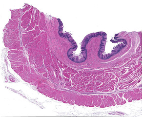 Wall Mural - Layers of the esophagus