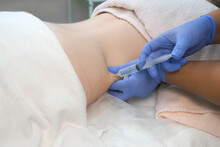 Doctor Makes Injection Of Ozone Gas In Patient Abdomen On Side On Ozone Therapy, Closeup View. Treatment, Cure And Remove Of Skin Tags And Stretches. Cosmetologist Woman In Gloves.