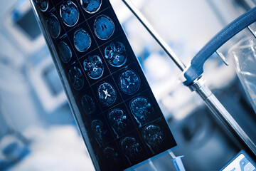 Wall Mural - MRI film of human brain hanging on the tripod in the hosptal ward