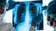 © yurolaitsalbert - close up. doctors in protective clothing discussing an x-ray of the lungs .