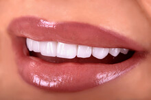 Perfect Close Up Sensual Beautiful Sexy Seductive Pink  Lips Woman Smile With Tongue . White Teeth Bleaching Ceramic Crowns Whitening Young Lady. Dental Zircon Implants Restoration Surgery