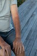 elderly man with bad condition skin from sun damage