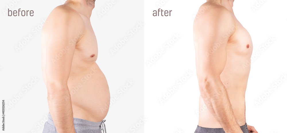 Man weight fat loss before after.  Belly fatness of man. Fat tummy problem. Man has fat abdomen. Before after of abdominous man. - obrazy, fototapety, plakaty 