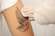 © New Africa - Young man undergoing laser tattoo removal procedure in salon, closeup