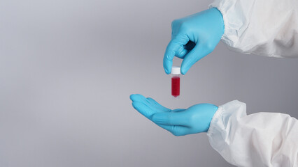 Blood tube. Covid 19 Test. doctor hand holding a blood sample tube for analysis in the lab background. Technician in medical gloves holding blood tube test for research vaccine to protect virus infect