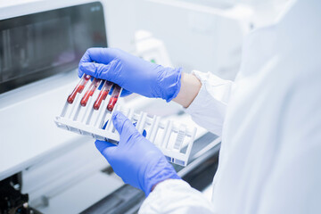 Scientist wear glove holding test tube in sample rack to check qulity of sample.