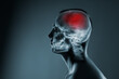 © hamara - X-ray of a man's head. Cerebral stroke. Brain damage is highlighted by red colour.
