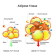Adipocytes, obesity, and inflammation. normal, and obese adipose tissue.
