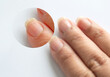 © Praewphan - Zoomin image of brittle weak dry cracked pitted woman's fingernails surface and prone to breakage caused by harsh ingredients in nail polish formulas on white background.