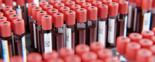 EDTA Serum Blutproben Röhrchen In Labor