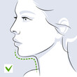 Woman profile double chin after. Woman face. Vector illustration