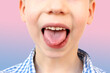 boy, kid performs articulation exercises for mouth, concept of speech disorders, correction, frenum of tongue, methods of correctional development