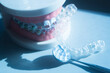 © edwardolive - Invisible bracket aligners