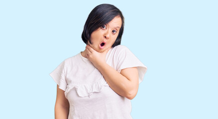 Wall Mural - Brunette woman with down syndrome wearing casual white tshirt looking fascinated with disbelief, surprise and amazed expression with hands on chin