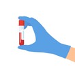 © Rogatnev - Doctor Hand holding test tube with blood isolated on white. Medical background, advertising websites. Laboratory research. Equipment for analysis. Vector illustration in flat style