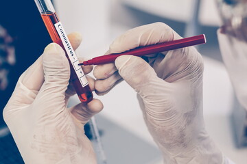 Wall Mural - close up. scientist marking a tube with a test.