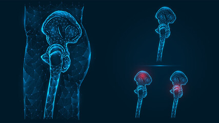 Polygonal illustration of human pelvic and hip bones side view. Disease, pain and inflammation of the pelvis and hip joint. Low poly human leg bones model isolated on dark blue background