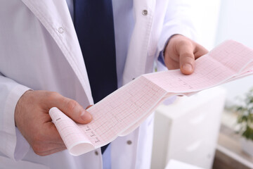 Doctor examining cardiogram in medical clinic, closeup