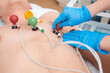 © salomonus_ - Cardiogram of the heart. The doctor attaches electrodes of an electrocardiograph to the patient’s chest. Cardiology