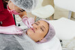 © Andrii - Cosmetology procedure for lip augmentation and wrinkle removal for a young beautiful girl. Cosmetology