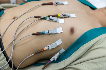 Wall Mural - Heart electrocardiogram or monitoring using Holter for young patient. Male athlete does a cardiac stress test. wearing Holter monitor device for daily monitoring of an electrocardiogram. 