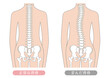 © matsukiyo - Pelvis and spine anatomy illustration