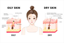 Oily & Dry Skin. Different. Human Skin Types And Conditions. A Diagrammatic Sectional View Of The Skin. 