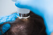 Examination of the patient's scalp with a trichoscope. Trichoscopy of hair follicles
