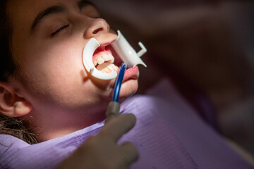 Canvas Print - Applying braces for teeth to a cute little girl in dentist studio, patient wearing a mouth  opening tool