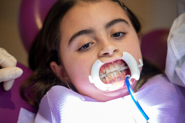 Canvas Print - Applying braces for teeth to a cute little girl in dentist studio, patient wearing a mouth  opening tool