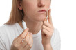 © New Africa - Woman with herpes applying cream on lips against white background, closeup