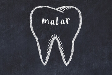 Wall Mural - Chalk drawing of a tooth with medical term malar. Concept of learning stomatology