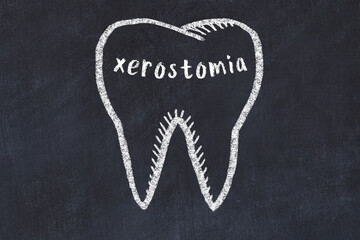 Wall Mural - Chalk drawing of a tooth with medical term xerostomia. Concept of learning stomatology
