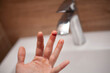 © Артем Барынин - The man cut his finger. A cut. Blood flows from the finger