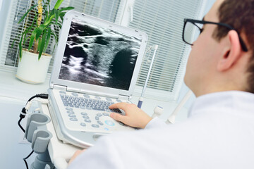 the doctor examines the result of an ultrasound examination of the thyroid gland on the monitor.