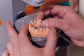 The process of making a dental prosthesis in a dental laboratory.