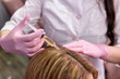 © alfa27 - cropped female person at trichologist office get injections in head skin by professional doctor's hands holding disposable syringe under patient's head. Porcedure against hair loss and for skin health