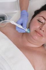 Vertical close up of a plus size woman getting vacuum pores cleaning treatment by cosmetician