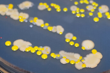 Macro view of bacteria and baker yeast colonies