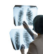 © Андрей Жерновой - A female doctor or radiologist examines a chest x-ray of a patient in a hospital. Pulmonology and cardiothoracic surgery concept. Control and monitoring of diseases of the lungs and respiratory organs