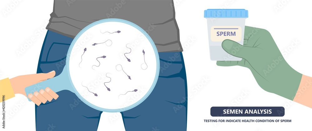 fototapete-semen-test-sample-sperm-count-type-male-biopsy-fertility-collect-low-poor-zero-head