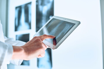 doctor is using a digital tablet to communicate with the patient.