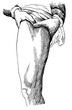 Compression of the injured femoral artery with both thumbs. Illustration of the 19th century. Germany. White background.