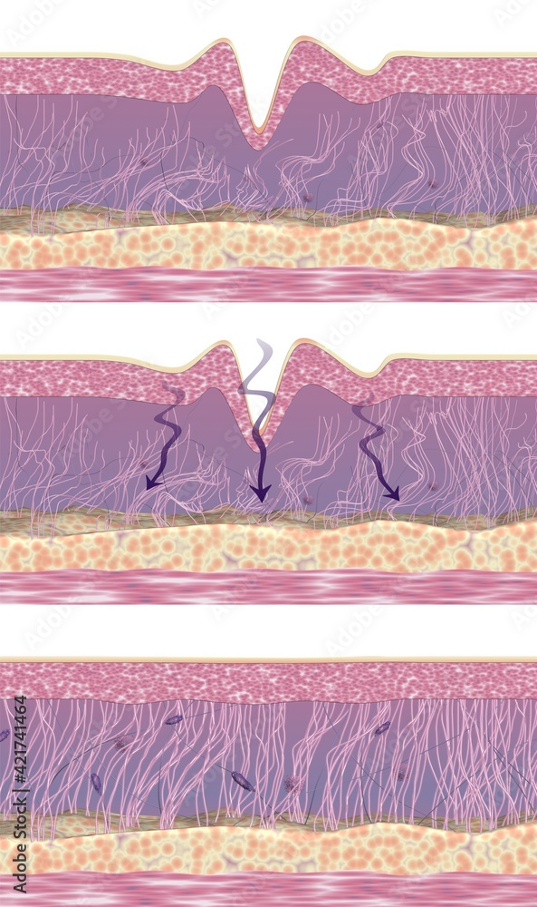 Process of regeneration collagen and elastin fibers in skin tissue ...