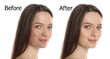 © New Africa - Young woman before and after cosmetic procedure on white background